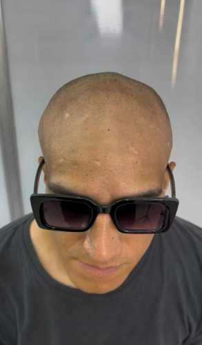 ANTES / Miguel