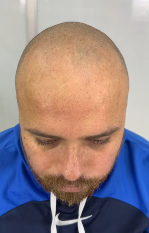 ANTES / Nicolás
