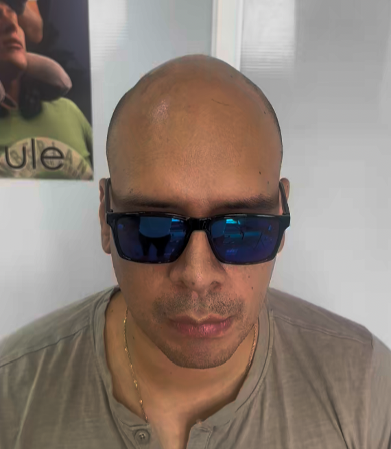ANTES / Lucas