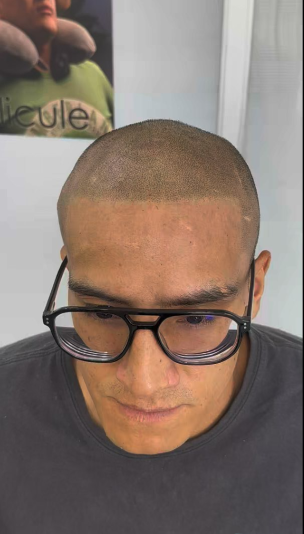 DESPUES / Miguel