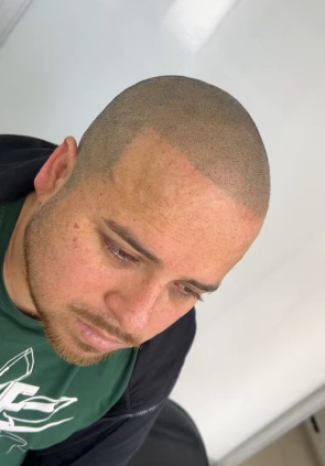 DESPUES / Nicolás