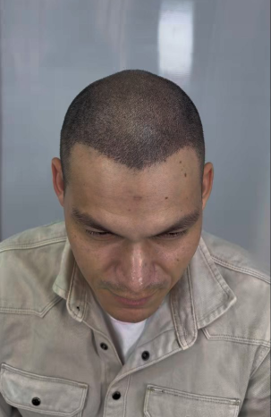DESPUES / Robert