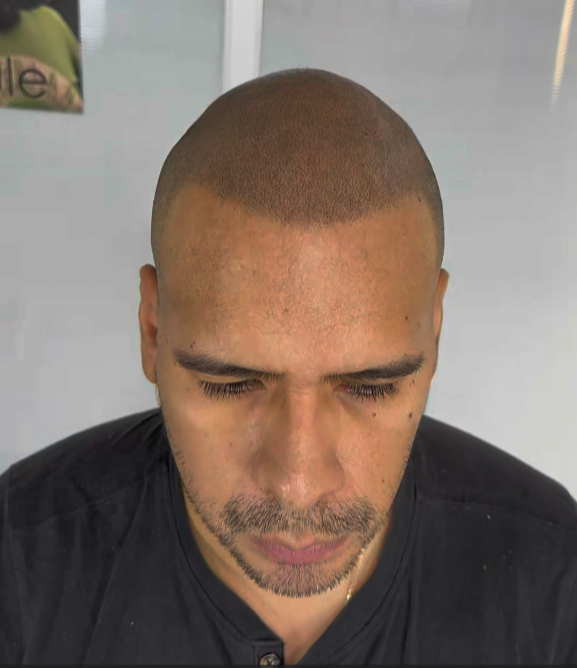 DESPUES / Lucas